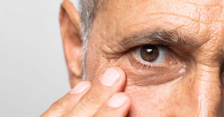 What Is a Cataract? Causes, Symptoms, and When to See a Doctor